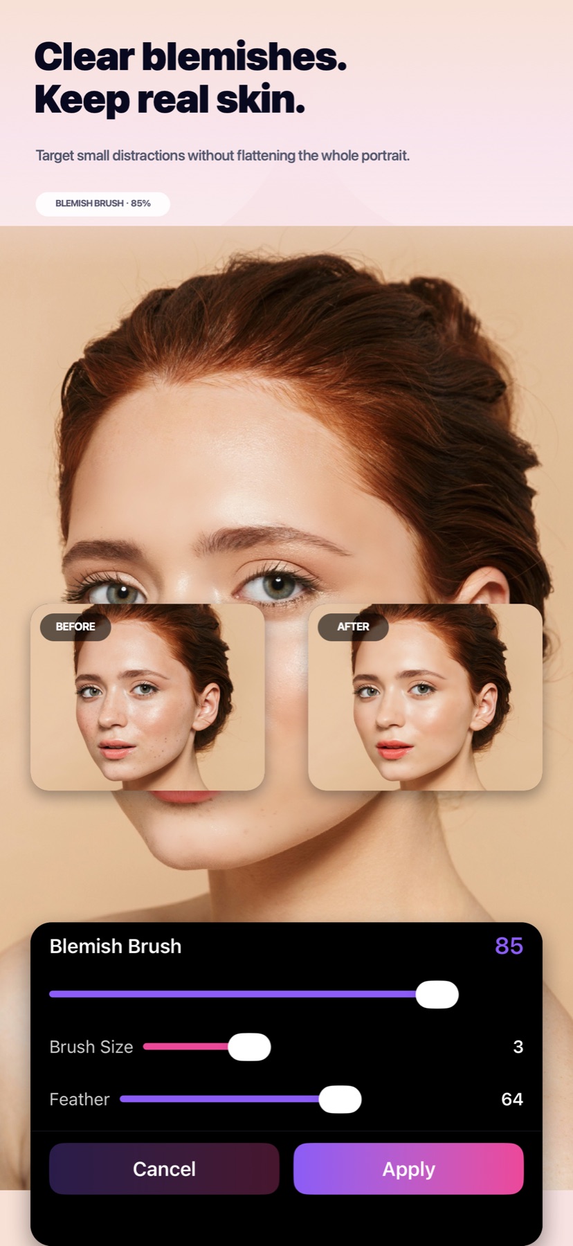 FaceRefine 局部祛痘功能